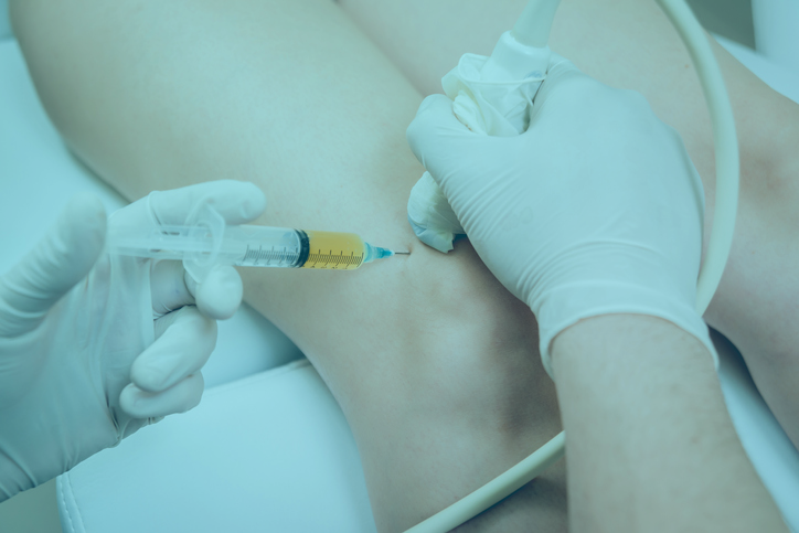 Platelet Rich Plasma (PRP) Injection in the knee brings pain relief