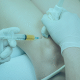 Platelet Rich Plasma (PRP) Injection in the knee brings pain relief