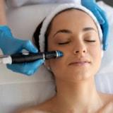 RF Microneedling Improves Skin