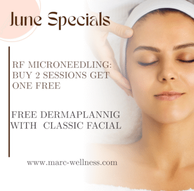 MARC June Specials On RF Microneedling (Gastonia, NC)