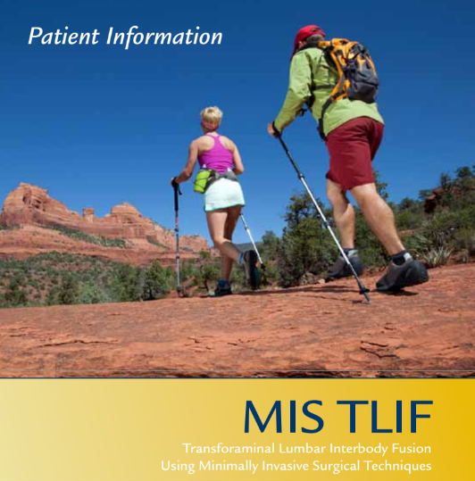 Transforaminal Lumbar Interbody Fusion (MIS TLIF)
