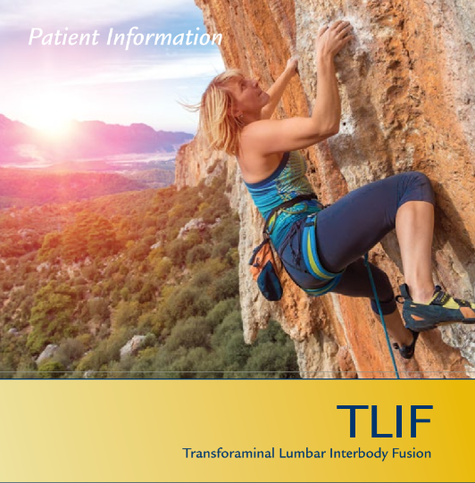 Transforaminal Lumbar Interbody Fusion (TLIF)