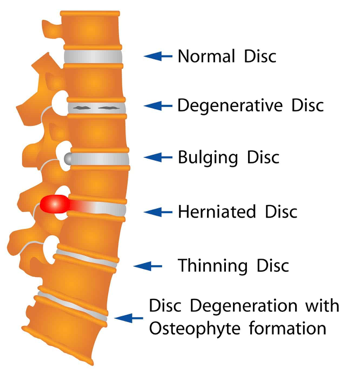 spine2