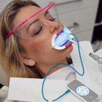 GLOChairside_Whitening_with_Autoclavable_MP