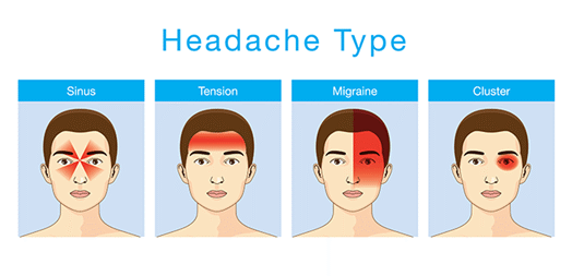 Headache Type Graphic