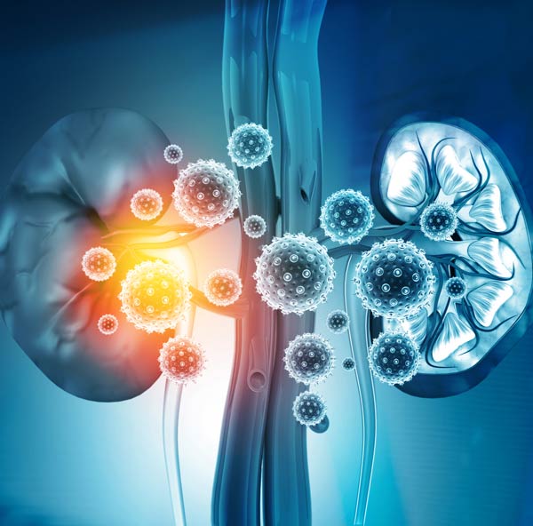 kidney disease illustration
