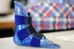 Prosthetics and Orthotics